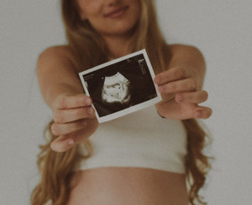 Nė&scaron;čiosios fotosesija - Fotosesijos, Reels, Socialinių tinklų turinio kūrimas - 1