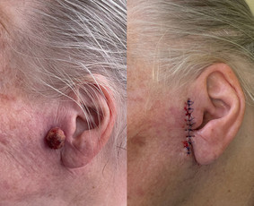 Dermatologai - Dermatologas Kaune- Orinta Klimaitė - 4