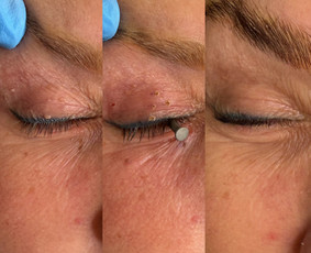 Dermatologai - Dermatologas Kaune- Orinta Klimaitė - 3