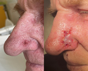 Dermatologai - Dermatologas Kaune- Orinta Klimaitė - 2