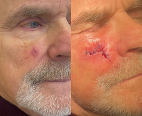 Dermatologai - Dermatologas Kaune- Orinta Klimaitė - 1