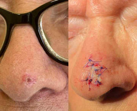 konsultacija pas dermatologa