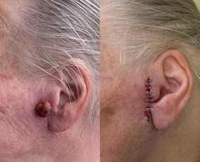 Dermatologas Kaune- Orinta Klimaitė / Orinta Klimaitė / Darbų pavyzdys ID 4460066