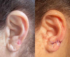 Dermatologas Kaune- Orinta Klimaitė / Orinta Klimaitė / Darbų pavyzdys ID 4460068