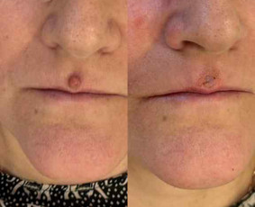 Dermatologas Kaune- Orinta Klimaitė / Orinta Klimaitė / Darbų pavyzdys ID 4460070