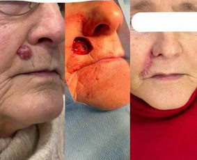 konsultacija pas dermatologa