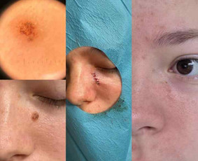 dermatovenerologas