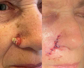 dermatovenerologas