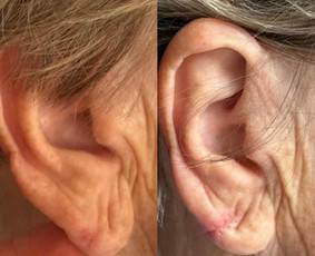 dermatovenerologas