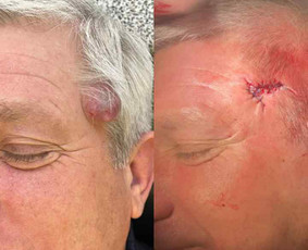 dermatovenerologas