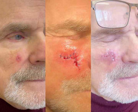 dermatovenerologas