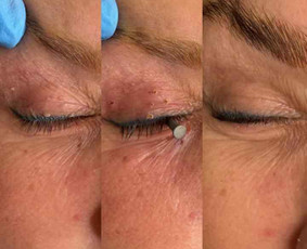 dermatovenerologas