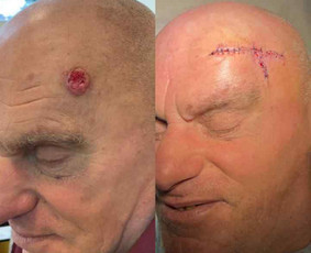 dermatovenerologas
