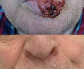 dermatovenerologas