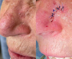 Dermatologas Kaune- Orinta Klimaitė / Orinta Klimaitė / Darbų pavyzdys ID 4460138