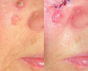 Dermatologas Kaune- Orinta Klimaitė / Orinta Klimaitė / Darbų pavyzdys ID 4460142