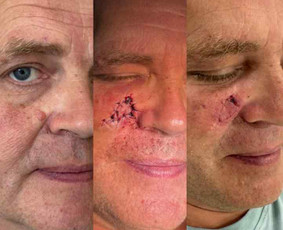 Dermatologas Kaune- Orinta Klimaitė / Orinta Klimaitė / Darbų pavyzdys ID 4460144