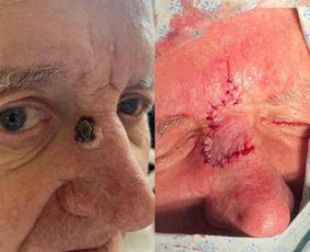 Dermatologas Kaune- Orinta Klimaitė / Orinta Klimaitė / Darbų pavyzdys ID 4460148