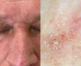 Dermatologai - Dermatologas Kaune- Orinta Klimaitė - 3