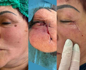 Dermatologai - Dermatologas Kaune- Orinta Klimaitė - 2