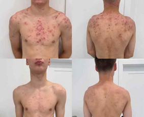Dermatologai - Dermatologas Kaune- Orinta Klimaitė - 1