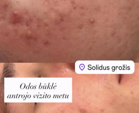 Kosmetologės - Profesionalios veido ir kūno procedūros! - 4
