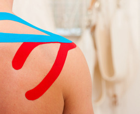 Kineziterapeutė Klaipėdoje - Kineziologinis teipavimas - 1 Kineziologinis teipavimas - Kineziterapeutė Klaipėdoje - 1