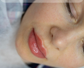 Lūpų mikropigmentacija - šešėliavimas