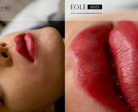 Lūpų permanentinis makiažas - Eglė - Permanentinis Makiažas Kaune - 4