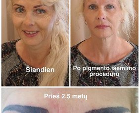 Blogų darbų korekcija. Registracija procedūroms:   Studija Ingida Permanent Klaipėdoje +370 69815160