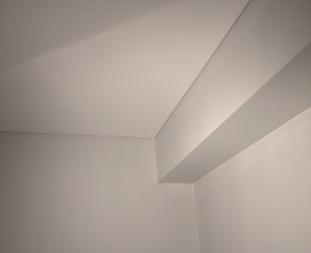 šešėlių siūlė