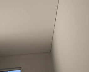 šešėlių siūlė