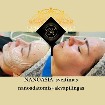 NANOASIA šveitimas nanoadatomis+akvapilingas Vilnius Grožio Laboratorija by Nataly nuotrauka 11