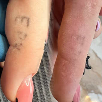 Permanentinio makiažo, mini tatuiruočių šalinimas Vilnius Vilma nuotrauka 6