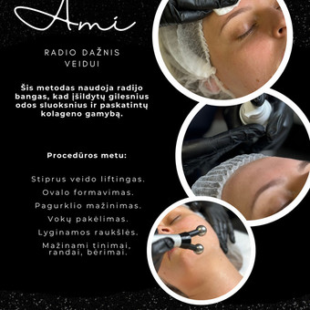 Radio dažnio procedūros veidui Tauragės rajonas MB Ami kūno dizaino studija nuotrauka 3