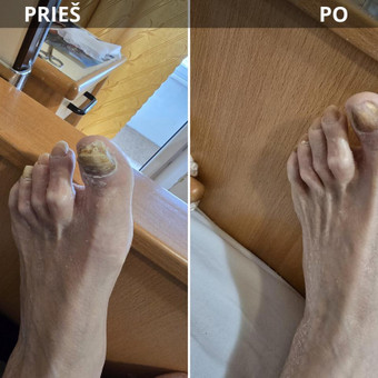 Pedikiūras Kaunas Aida nuotrauka 1