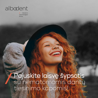 Banerių kūrimas Vilnius Sigita Kolesinskaitė nuotrauka 1