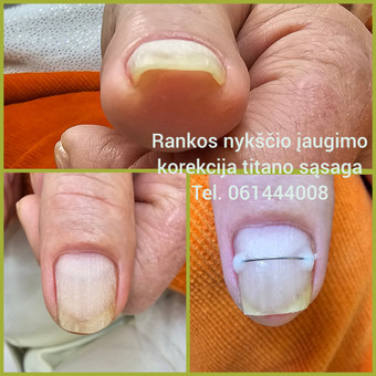 Titano sąsagos Kaunas Rasa Ž nuotrauka 6
