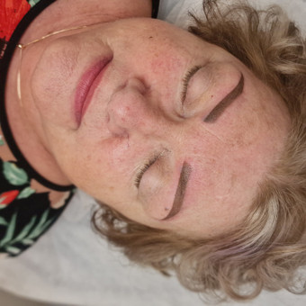 Permamentinio makiažo šalinimas lazeriu Jonavos rajonas Sandra Martis nuotrauka 4