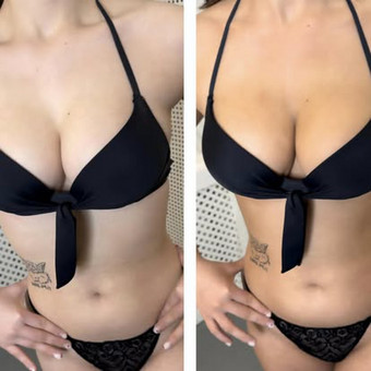 Purškiamo įdegio mokymai Klaipėda Carla grožio mokykla nuotrauka 9