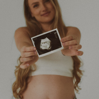 Nėščiosios fotosesija Kauno rajonas Aurelija Kasputytė nuotrauka 3