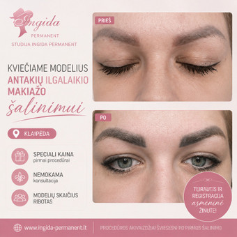 Permanento šalinimas / išėmimas / korekcija Klaipėda Ingida Oginskiene nuotrauka 7