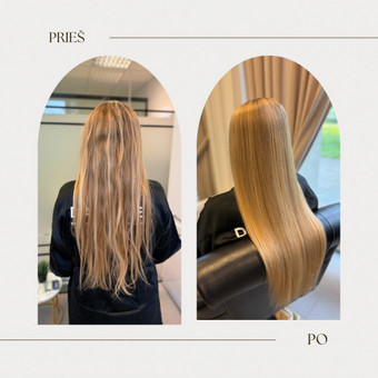 Šalto Botox procedūra Kaunas Beauty studio by S.D. nuotrauka 5