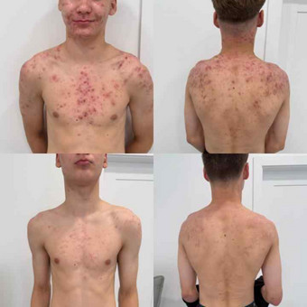 Dermatologo konsultacija Kaunas Orinta Klimaitė nuotrauka 1