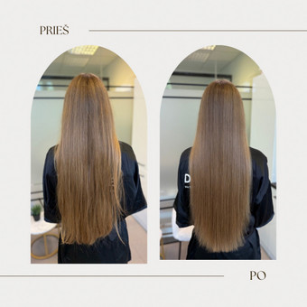 Šalto Botox procedūra Kaunas Beauty studio by S.D. nuotrauka 5