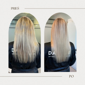 Šalto Botox procedūra Kaunas Beauty studio by S.D. nuotrauka 5
