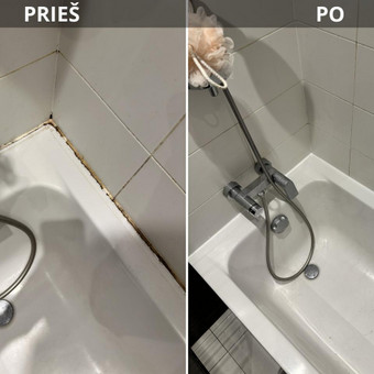 Seno silikono keitimas Vilnius Emilis Kirsnys nuotrauka 11