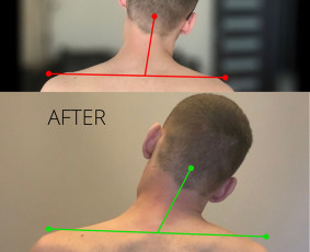 Kineziterapeutas, manualinės terapijos specialistas. - Kineziterapeutai - 1 Kineziterapeutai - Kineziterapeutas, manualinės terapijos specialistas. - 1