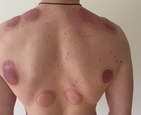 Kineziterapija namuose - Kineziterapeutas, manualinės terapijos specialistas. - 1