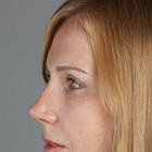 Indre Aguda